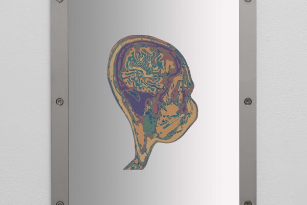 Sung Tieu, Exposure To Havana Syndrome, Brain Anatomy, Sagittal Plane, (Sample 8), 2024